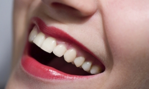 2 THE DENTAL CHECK UP